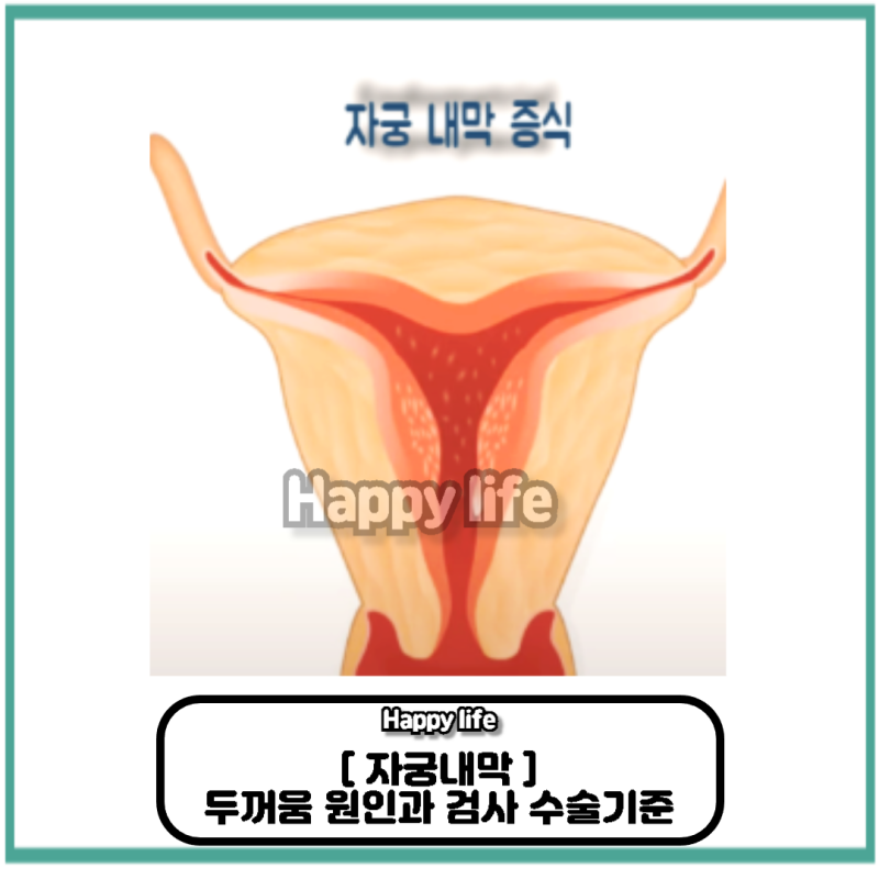 “자궁내막이 두꺼움, 정상인가요? 원인·검사·수술 기준