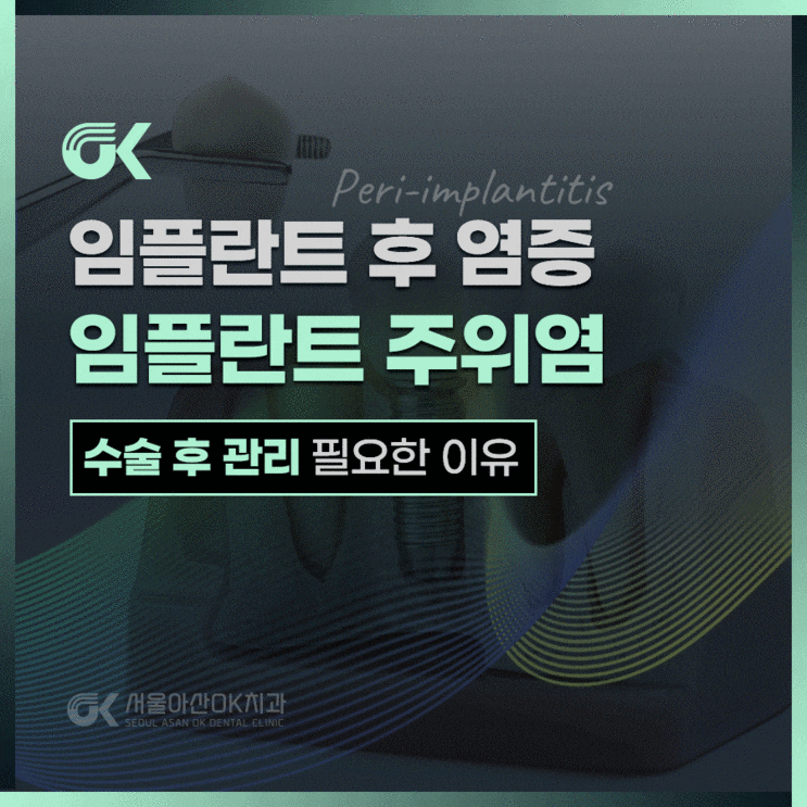  미사잇몸염증 임플란트 후 관리 필요하다면?