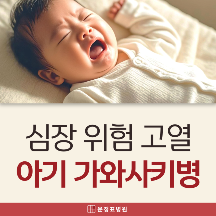  운정 소아과 입원, 아기 가와사키병 전염 후유증 증상 원인 총정리