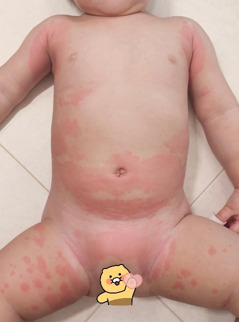  아기보습제 전문가가 실제 바르는 top3 아기보습제? 정작 전문가들은 이렇게 씁니다