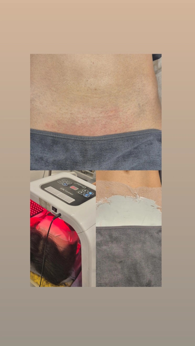  남자 브라질리언 왁싱 안아픈 곳, 트러블 없는 곳, 저렴한 곳. 영등포 남자 왁싱샵 "청춘케어"