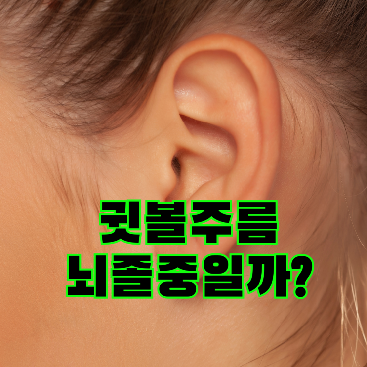  귓볼에 사선주름, 뇌혈관 뇌졸중일까?
