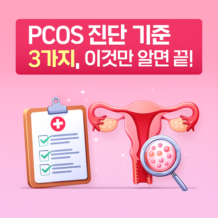  PCOS(다낭성 난소증후군) 진단 기준 한눈에 정리