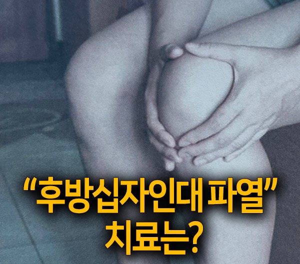 후방십자인대부분파열치료 받아야 하나 고민