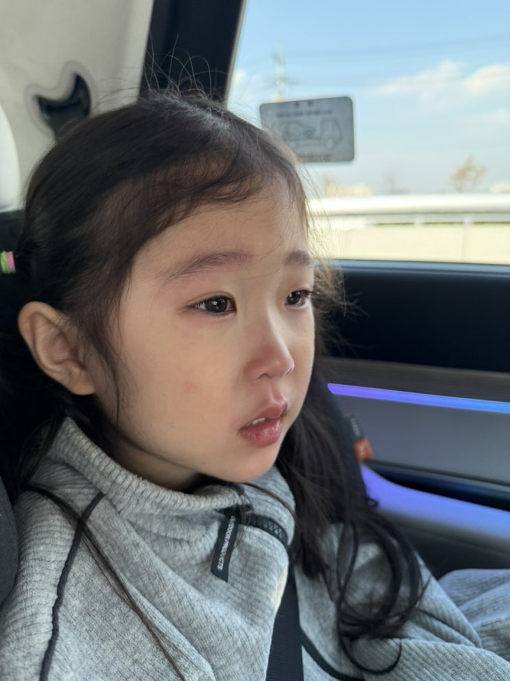  결막염 초기증상, 전염성 눈병 신호일까? 저희는 이렇게 나타났어요