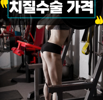 치질 수술가격 비교해보고 결정해야 할 이유!