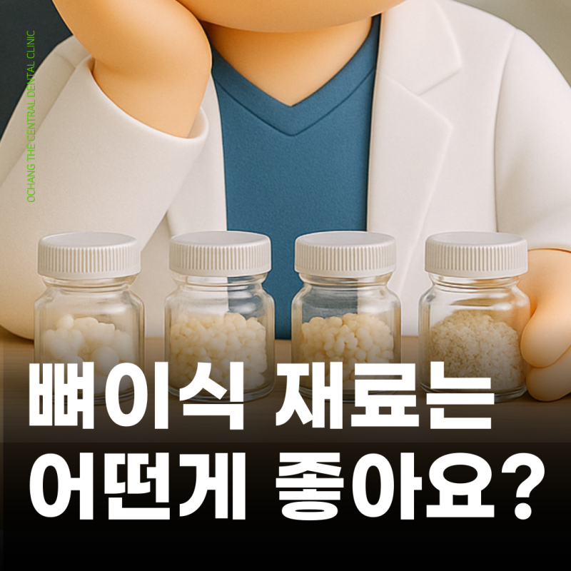 임플란트 뼈이식 재료 종류 비용 장단점