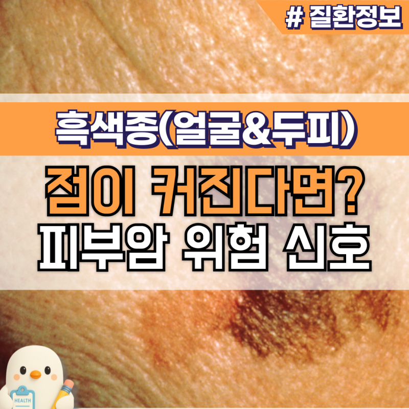 얼굴 흑색종 초기증상? 두피 점도 위험 피부과 방문 신호