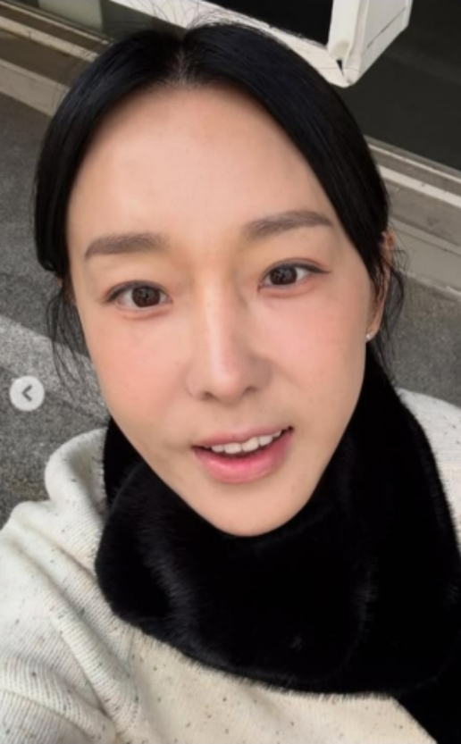   ‘인중축소술’ 후 확 달라진 이지혜…짧아진 인중, 부작용 고백까지?
