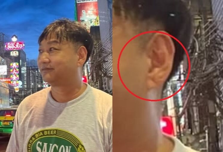  프랭크 징후 김수용 촬영 중 쓰러진 이유라고?