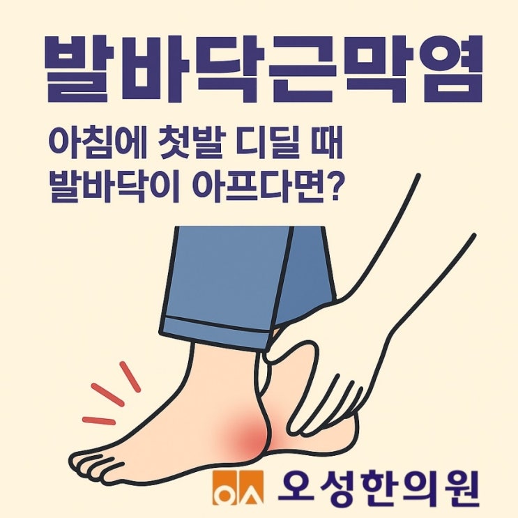  발바닥 근막염, 파주 봉일천 오성한의원.