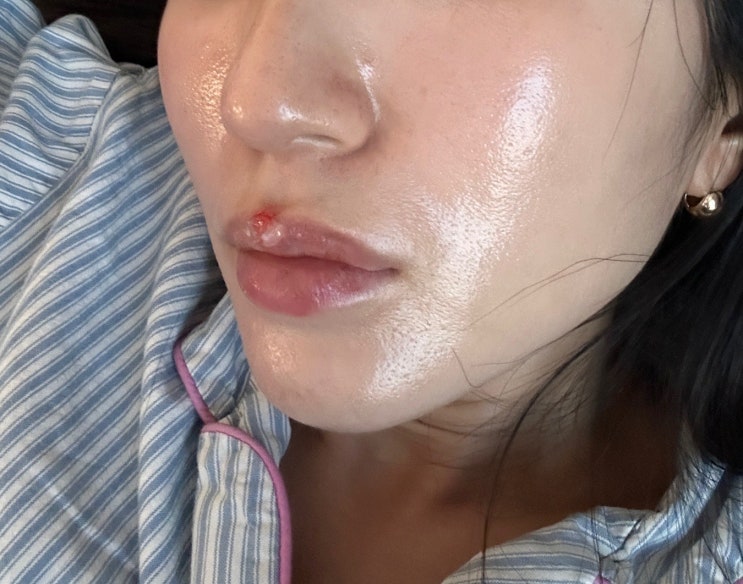  검단피부관리 스파롱슬로 속건조 트러블관리 글로우 스킨 후기