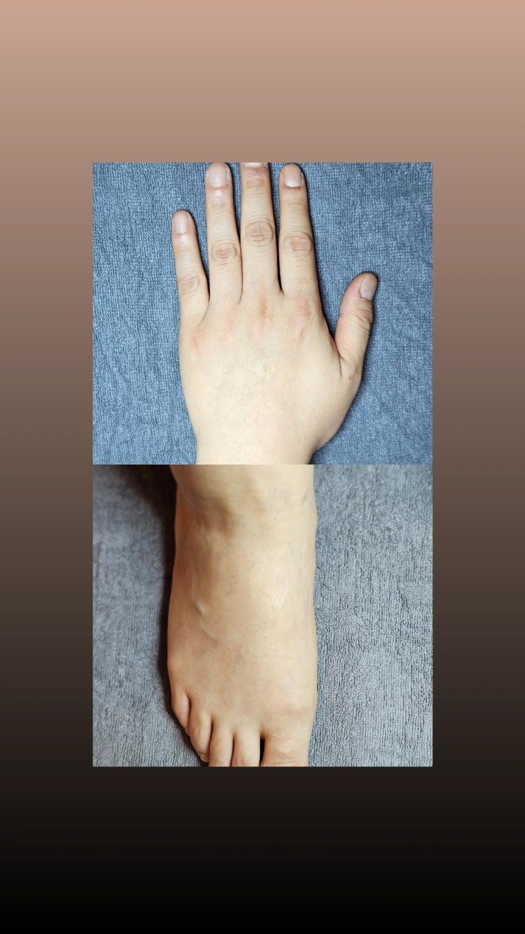  가을과 겨울에 어울리는 가성비 왁싱, 남자 손등 왁싱, 남자 발등 왁싱, 영등포 남자 왁싱샵 "청춘케어"에서