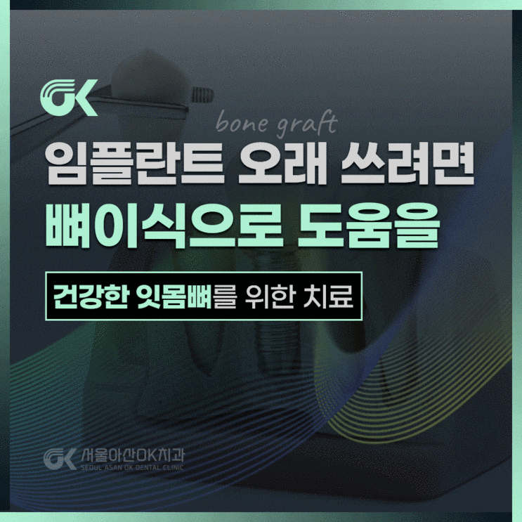  임플란트 오래 쓰려면? 미사 뼈이식