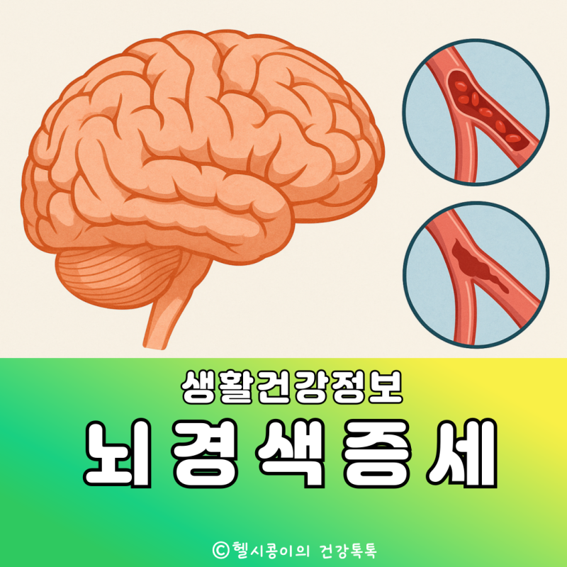 뇌경색과 뇌출혈 차이, 눈에 나타나는 전조증상부터 증세까지