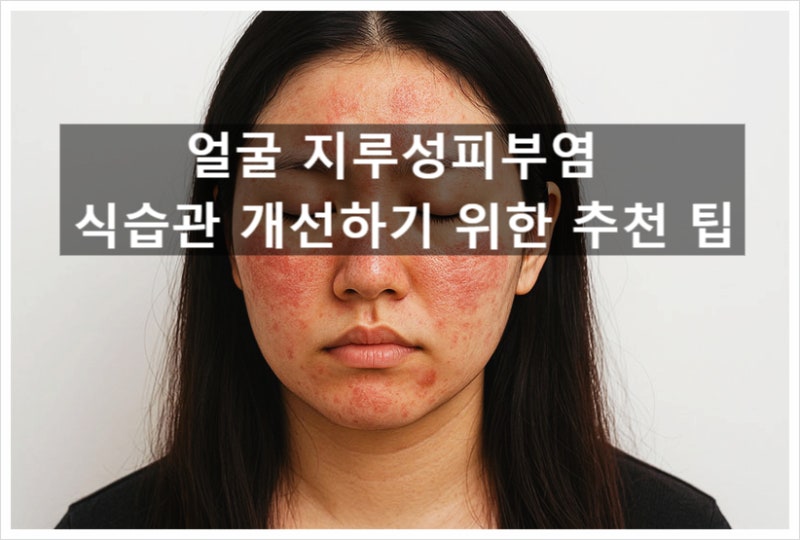 얼굴 지루성피부염 식습관 개선하기 위한 추천 팁?