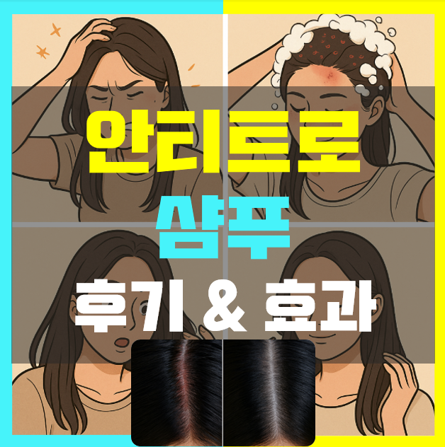 안티트로 샴푸 내돈내산 후기 사용법 비듬에 효과 있나(feat. 임산부)