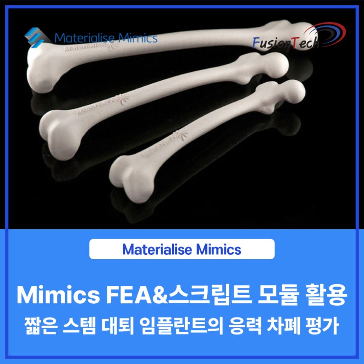  [Materialise S/W] Mimics FEA&스크립트 모듈 활용, 짧은 스템 대퇴 임플란트의 응력 차폐 평가