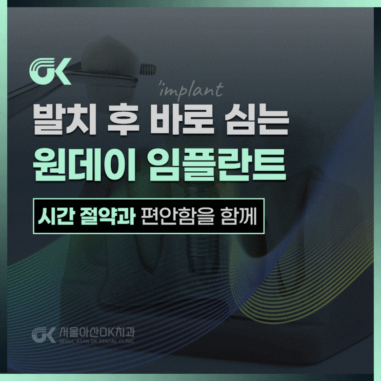  하남치과,  발치후 바로 심는 원데이 임플란트