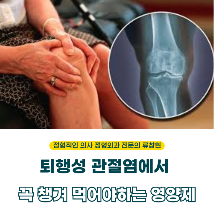  정형외과 의사가 알려주는 관절 영양제 팩트!  (의사작성)