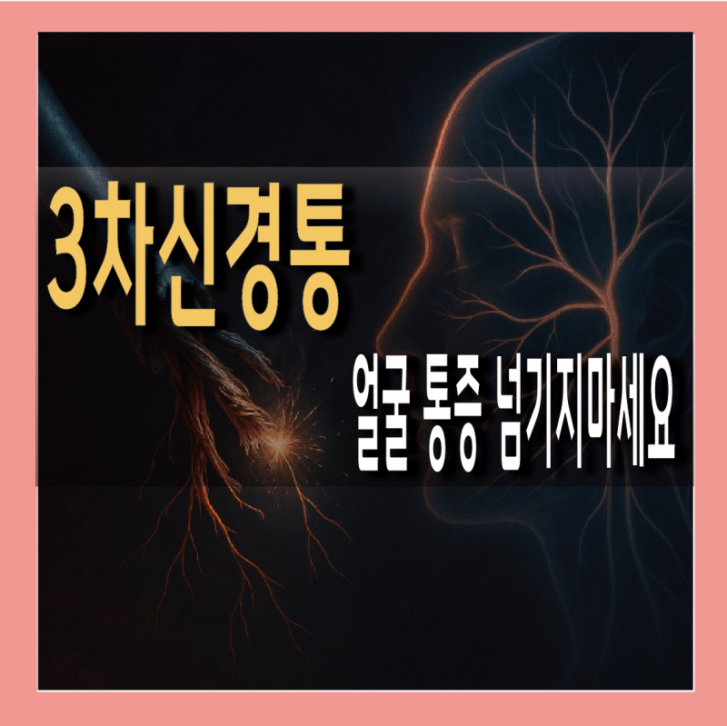 3차신경통 증상 원인 수술 방법 A to Z