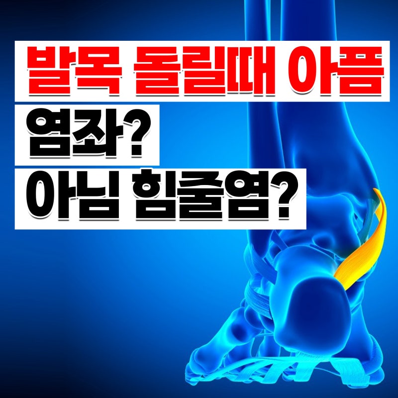 발목 돌릴때 아파요 난 염좌인가, 힘줄염인가?