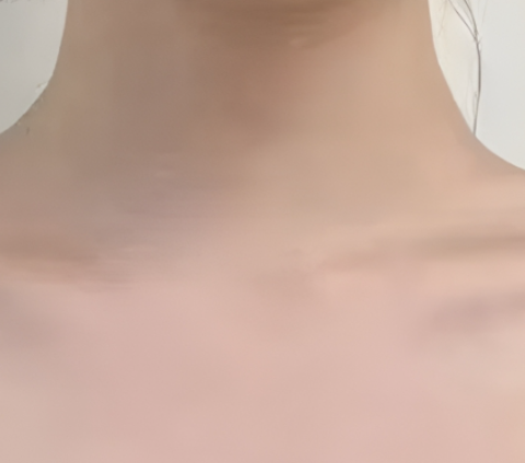  세로 목주름관리법 이렇게 했더니 달라짐