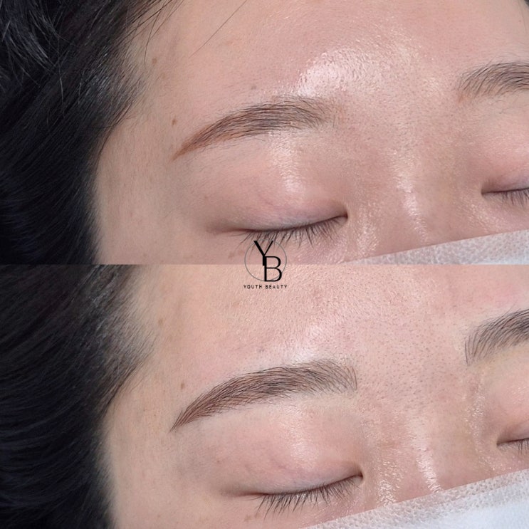  광주눈썹문신 잘하는곳 엄청난 잔흔.. 커버가 되네요