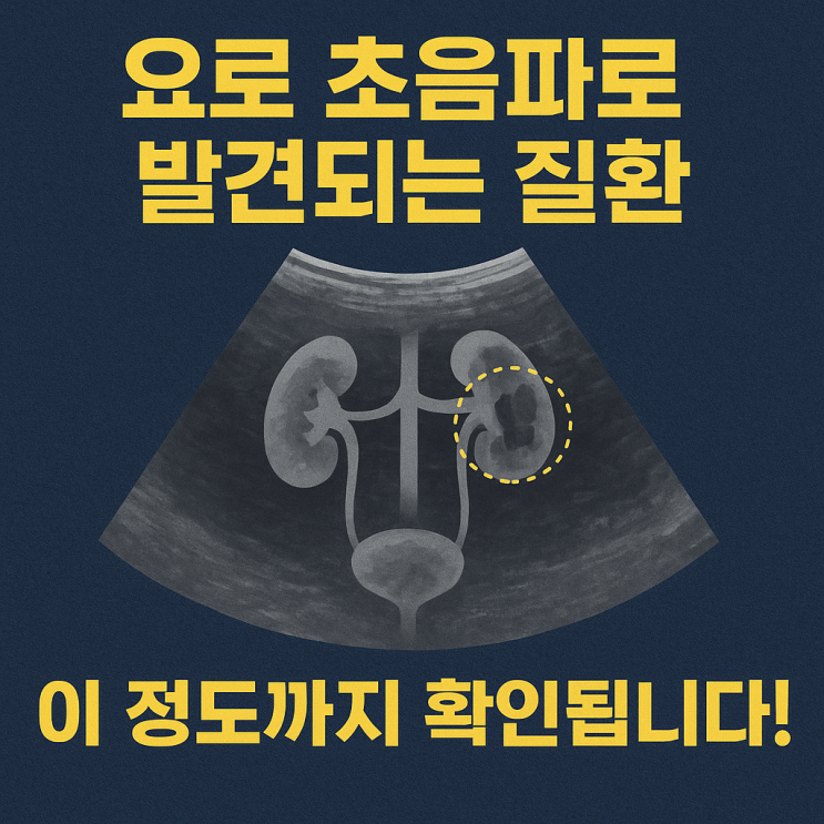   요로 초음파로 발견 가능한 질환들 한눈에 정리