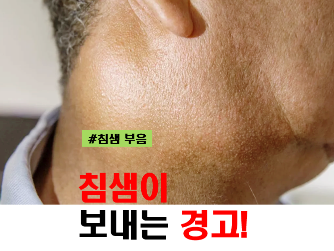 귀밑 침샘 부음 원인 및 병원
