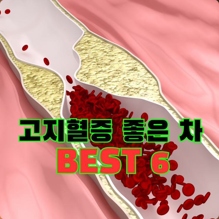  갱년기 고지혈증에 좋은 차, 종류와 마시는 법