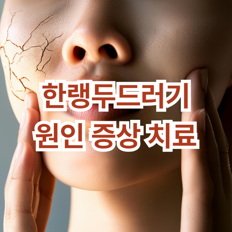 한랭두드러기 검사 얼굴 증상 검사 면역력 자가진단