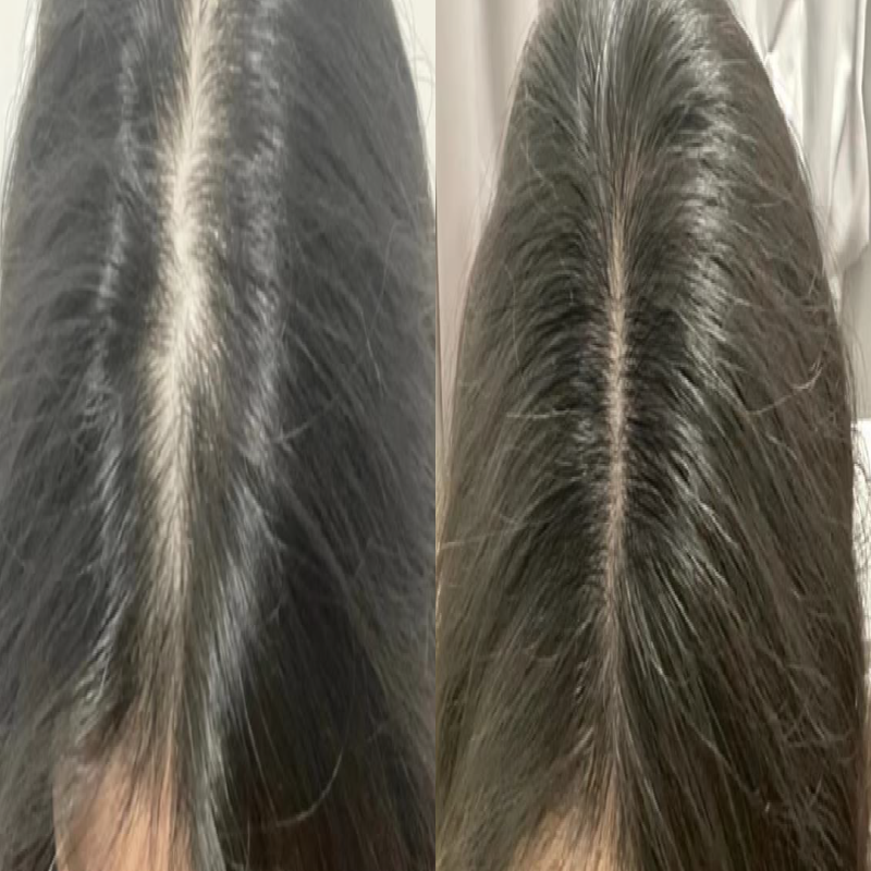 암웨이 탈모치료기 써보고