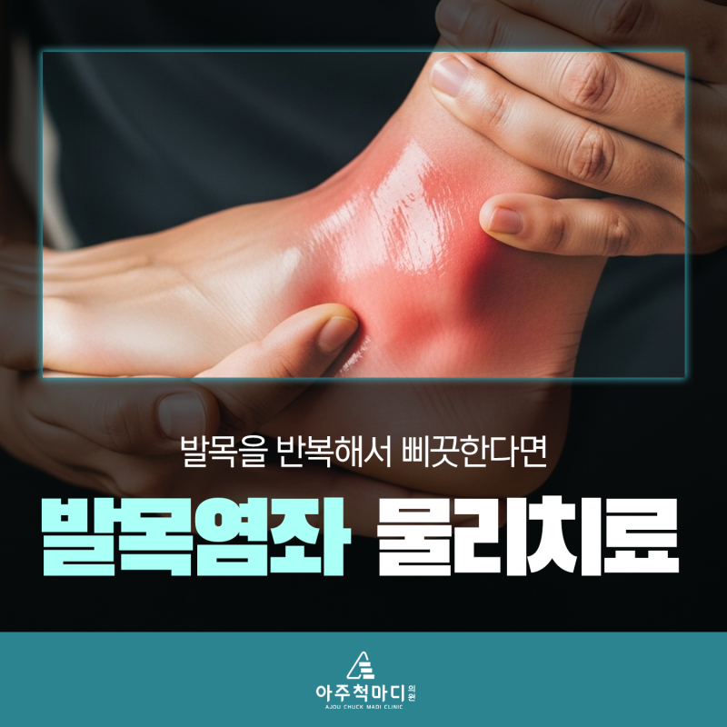 발목염좌 물리치료 발목을 반복해서 삐끗한다면