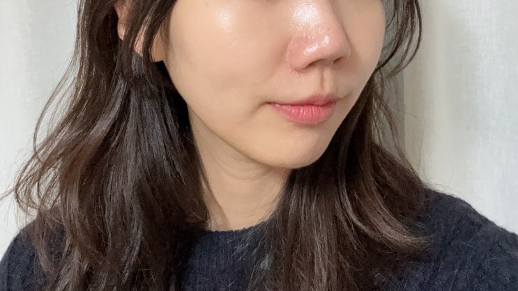  압구정 청담 온다 이중턱 리프팅 후기:) 통증, 효과, 비포애프터 기록