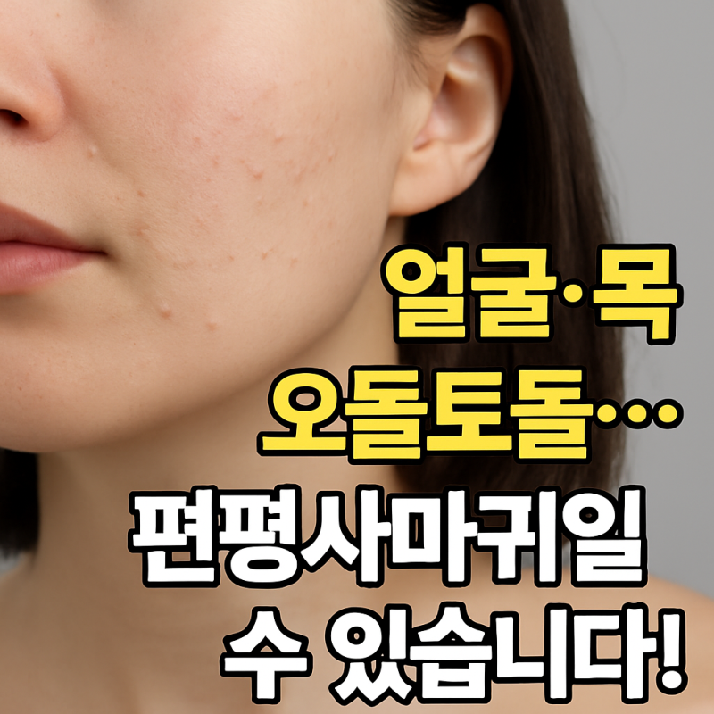 ❗ 편평사마귀?좁쌀여드름?? 원인 치료 실비보험까지