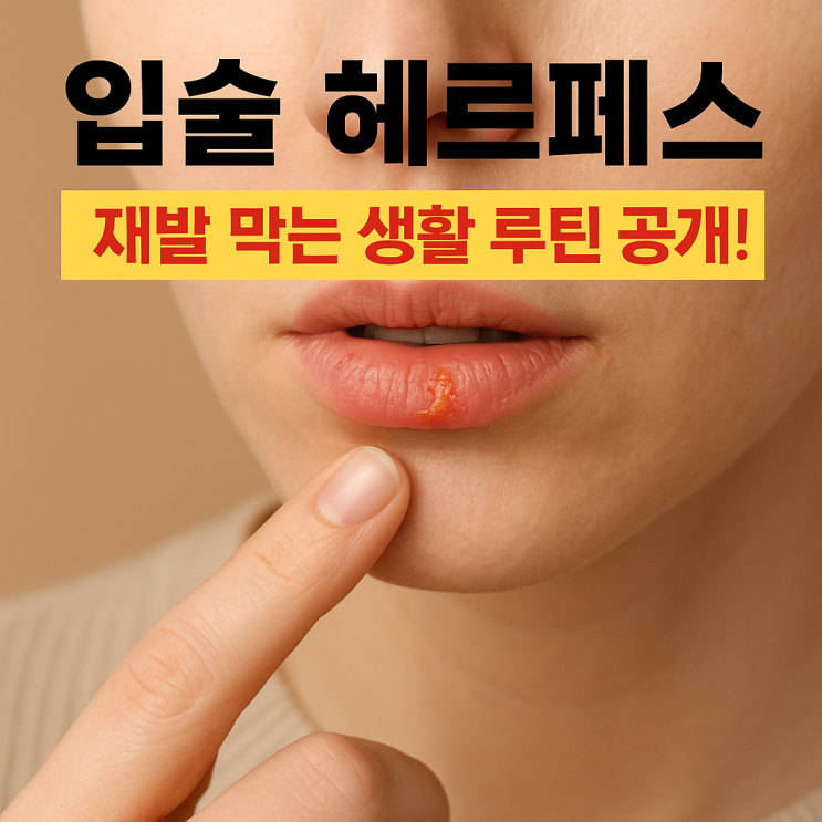  단순포진(입술 헤르페스), 재발을 줄이는 일상 전략