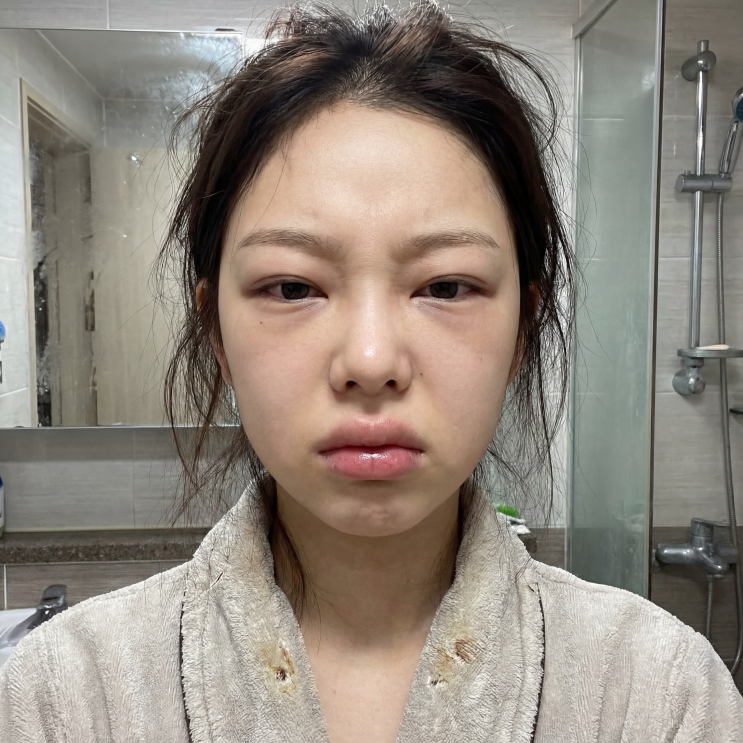  가장 빨리 체감되는 다이어트? 얼굴 붓기 제거 방법