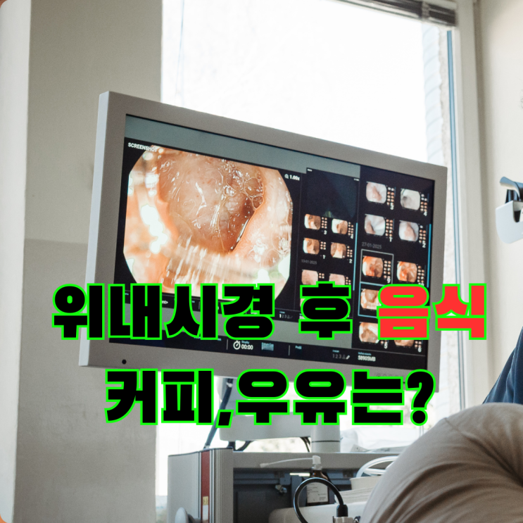  수면마취 위내시경 후 식사, 용종제거 후 먹을 수 있는 음식 (커피, 우유는?)