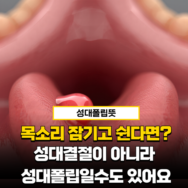 성대폴립뜻 성대결절이랑 뭐가 다를까? 혼동하기 쉬운 이유