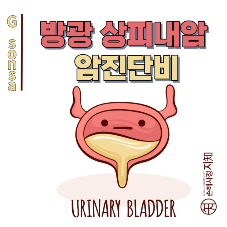  방광 상피내암 D09, '이것' 모르면 암진단비 90% 날립니다.