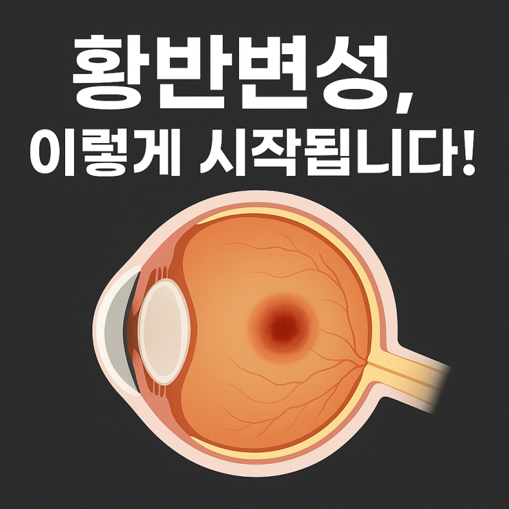  ️ 황반변성, 초기에 알아차리면 지킬 수 있습니다