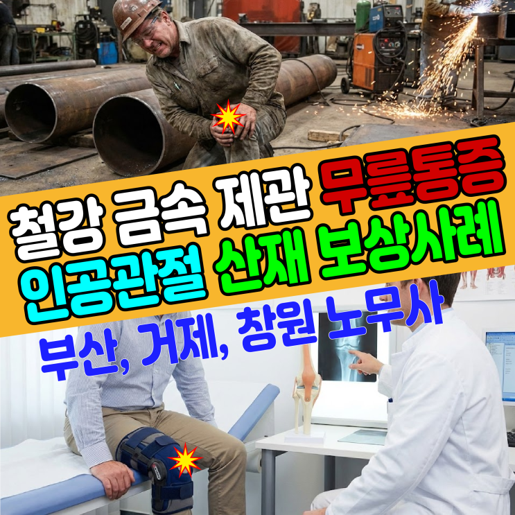  [부산, 거제, 창원 노무사] 철강 금속 제관 무릎통증 인공관절 산재 신청 보상사례
