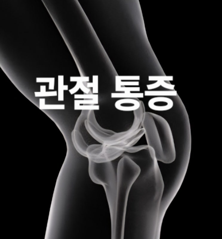  겨울철 관절 통증 악화되는 이유 | 관절 통증 완화하는 관절 건강 관리법