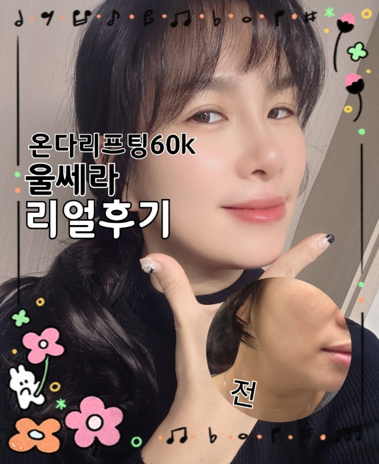  의정부 리프팅 추천｜의정부 피부과 온다리프팅 + 울쎄라 내돈내산 후기 이중턱 고민 해결
