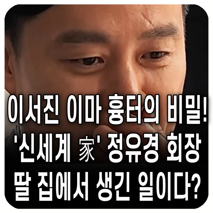 <b>이서진</b> 이마 <b>흉터</b>의 충격적인 비밀! 알고 보니 '<b>신세계</b>... 