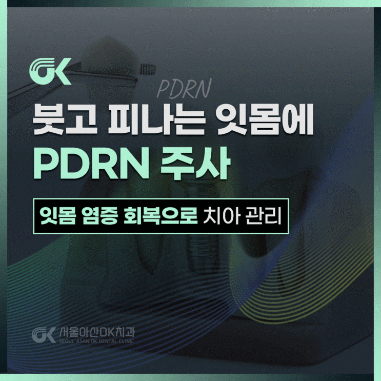  남양주시치과, 잇몸 염증에 도움 되는 PDRN 주사