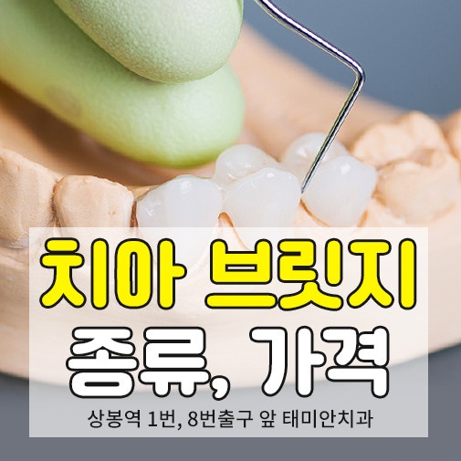 치과 브릿지 가격 앞니 어금니 치아 차이와 종류는