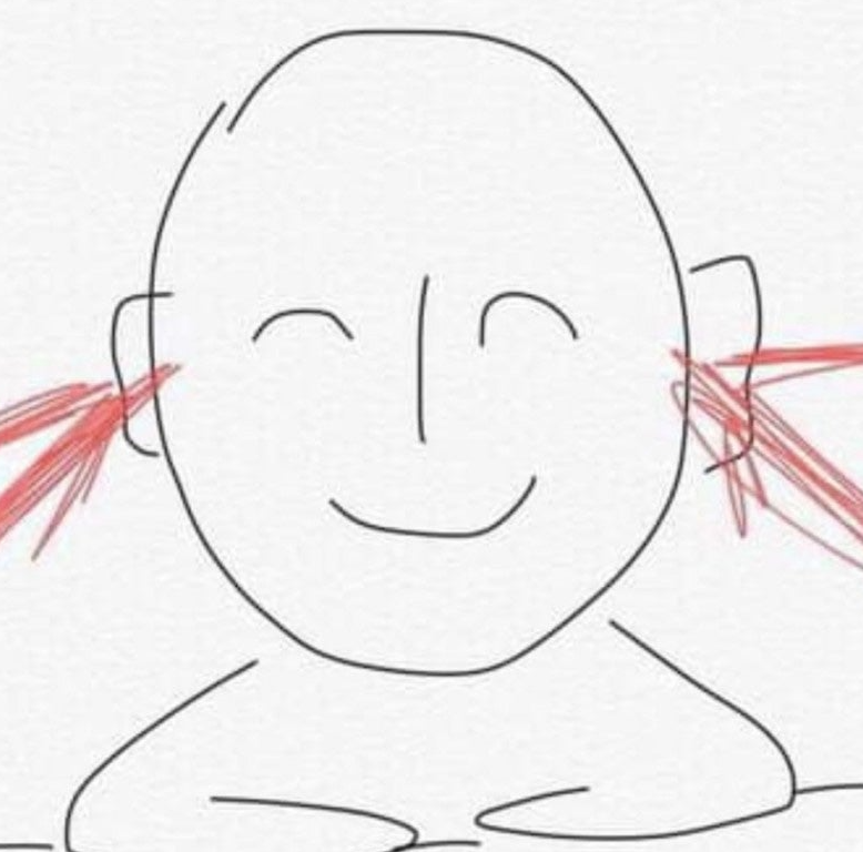 귓볼 염증 병원 갈래 말래? 응 안가고 싹 나음(관리팁)