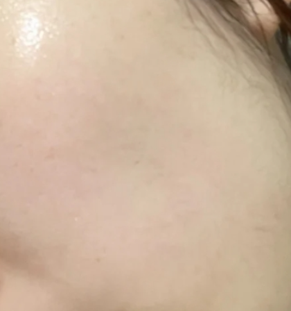  피부장벽 무너짐 복구 루틴